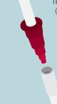 Farrell Bag - Legacy / Cone Connection - Closed Enteral Decompression System Gastric Pressure Relief Device - In Date